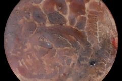 W6.5-00x-Ridged Volcanic World